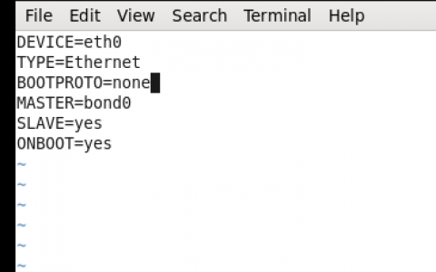 linux多网口绑定